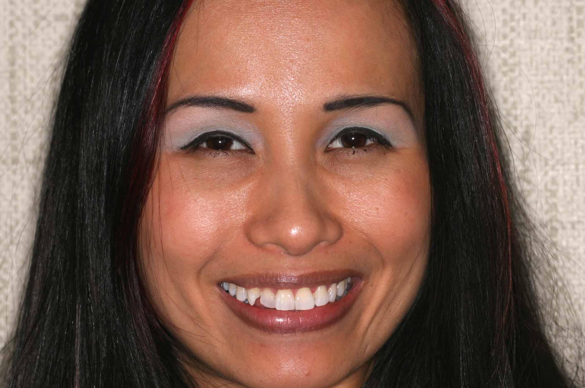 Cosmetic Dentist Fort Myers Cape Coral Naples FL